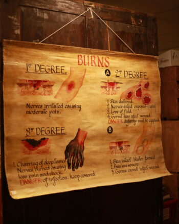Hand-painted Burns Medical Chart