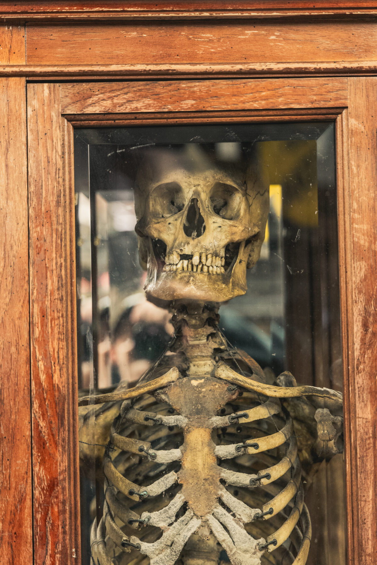 Full Human Skeleton in Display Case - On The Square Emporium
