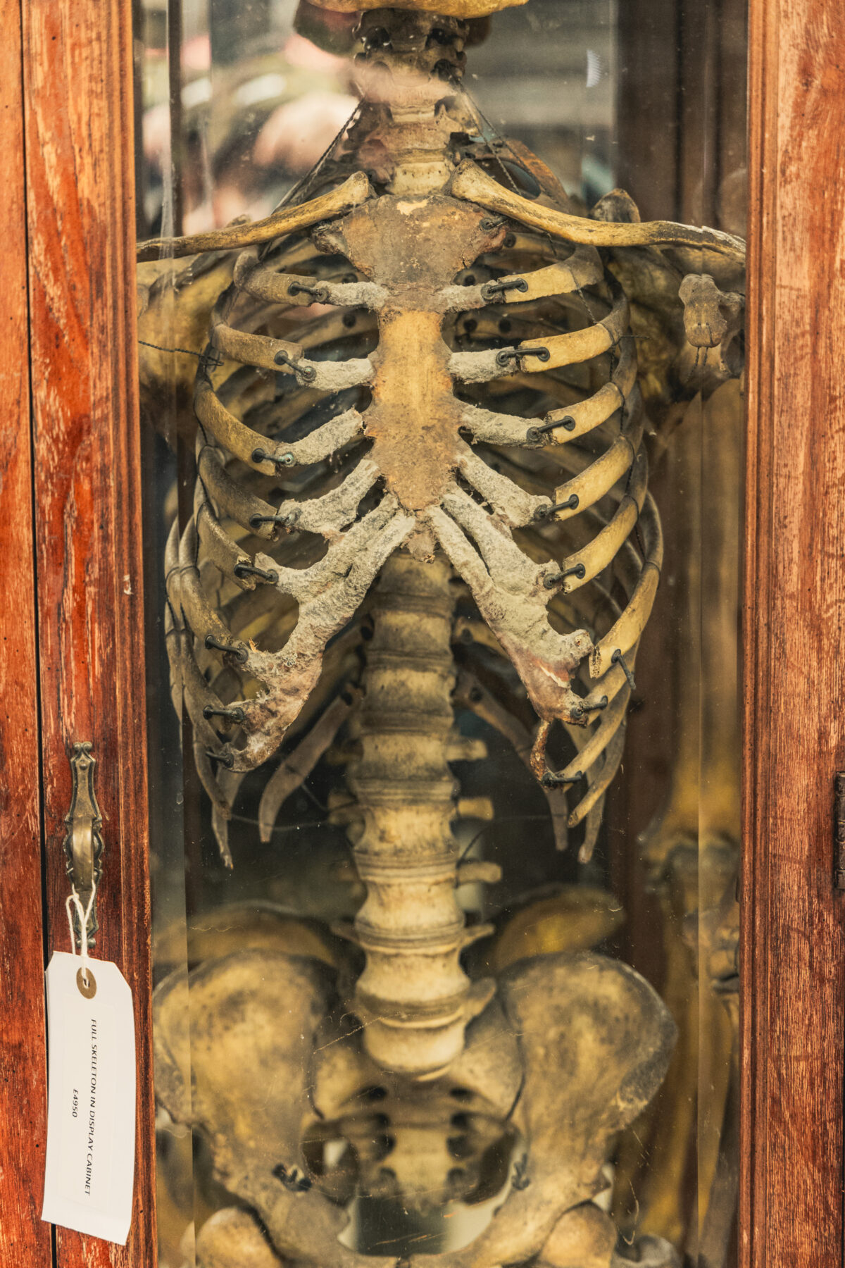 Full Human Skeleton in Display Case - On The Square Emporium