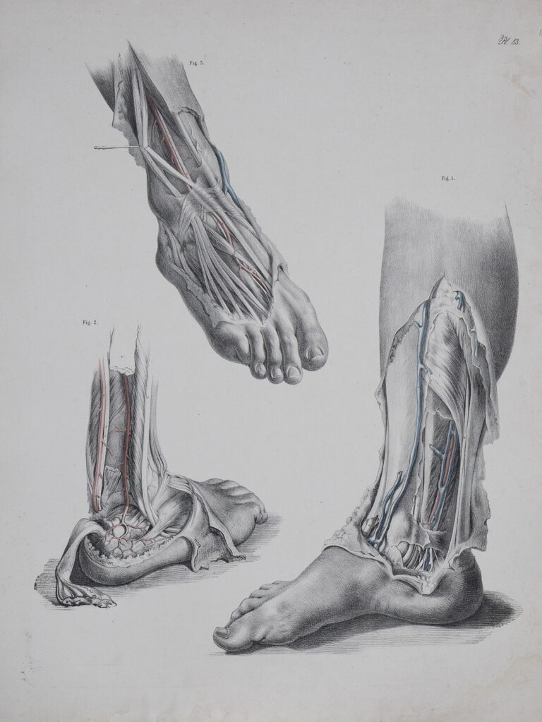 Victorian Post-Mortem Drawings