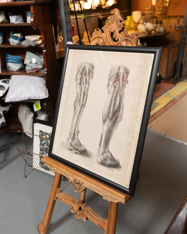 Original 1840 Lithographic Anatomical Drawing - Leg