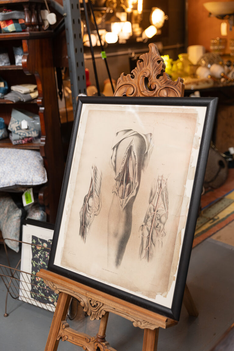 Original 1840 Lithographic Anatomical Drawing - Knee