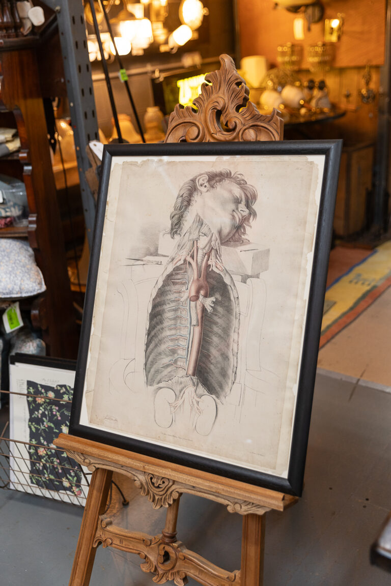 Original 1840 Lithographic Anatomical Drawing - Chest