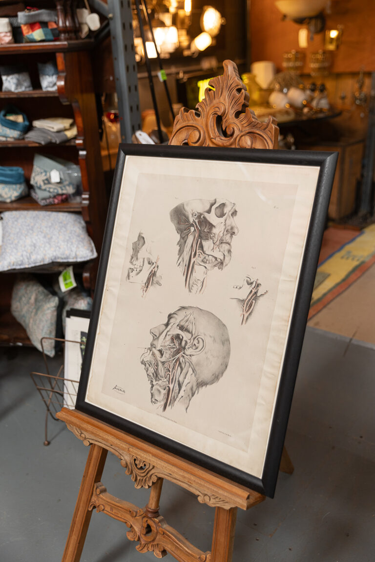 Original 1840 Lithographic Anatomical Drawing - Head