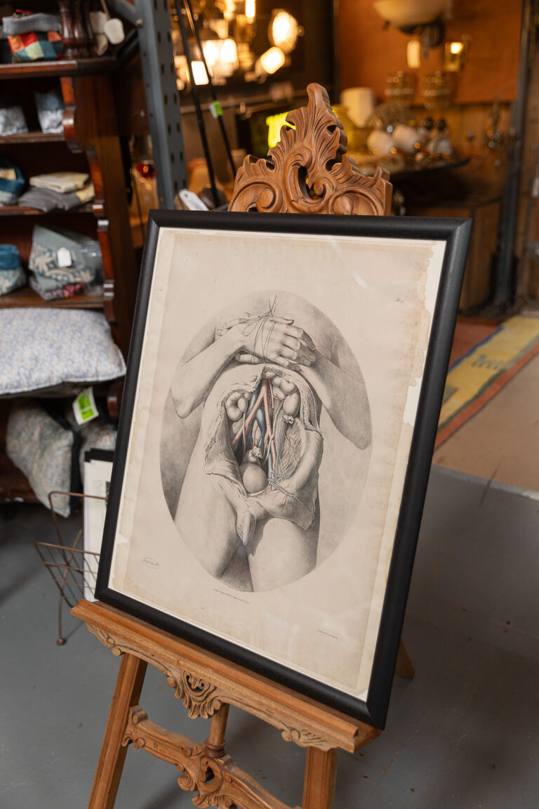 Original 1840 Lithographic Anatomical Drawing - Abdomen