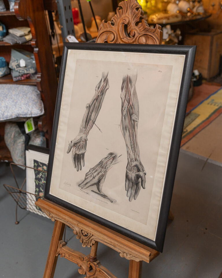 Original 1840 Lithographic Anatomical Drawing - Arm