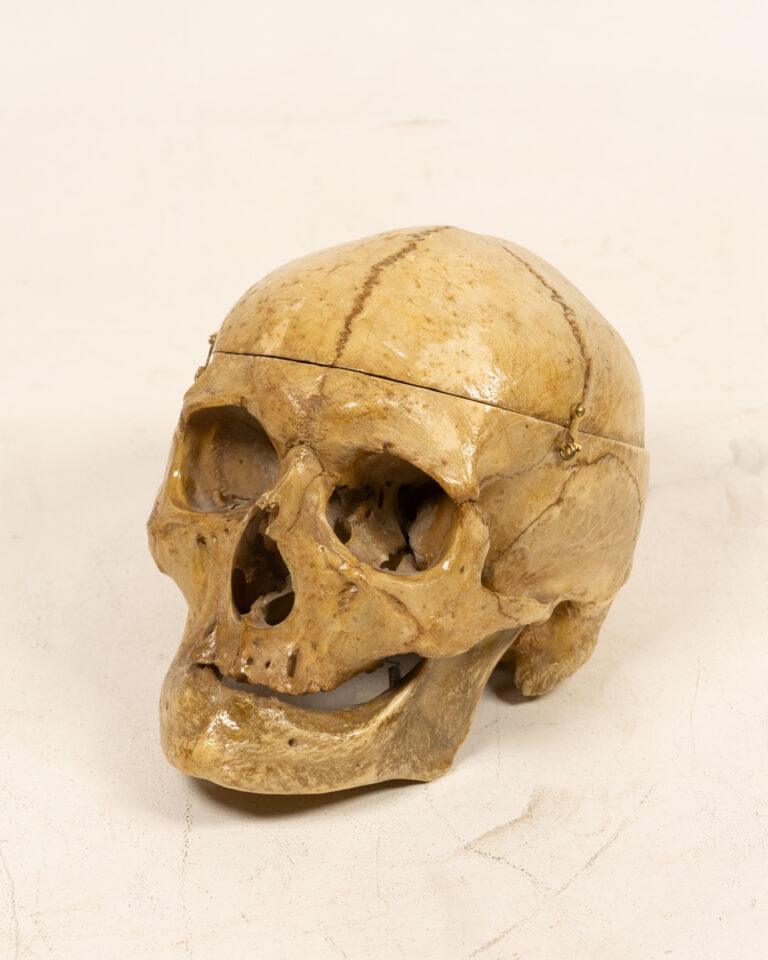 Human Skull with Hinged Calvarium