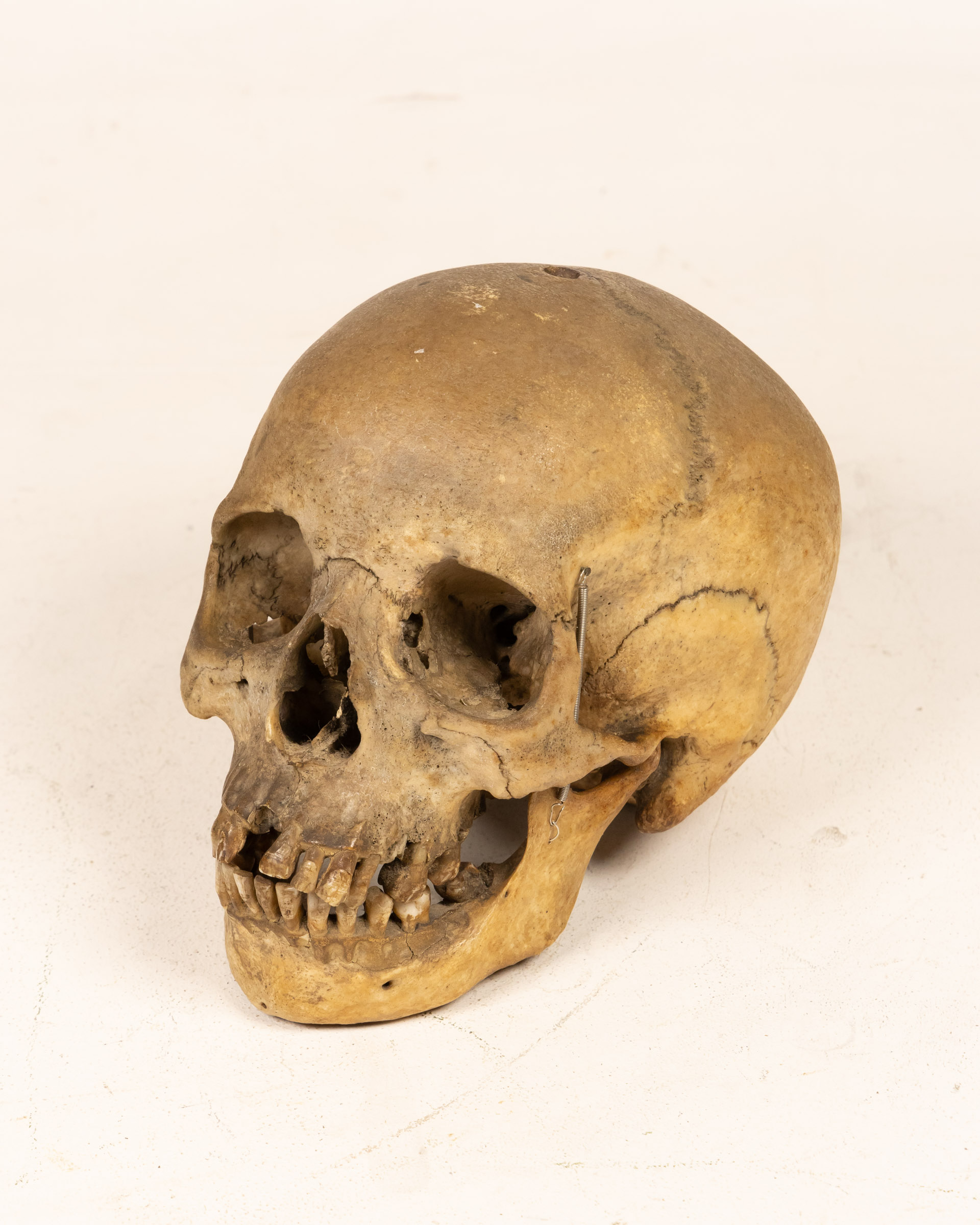 Anatomical Human Skull Medical Specimen