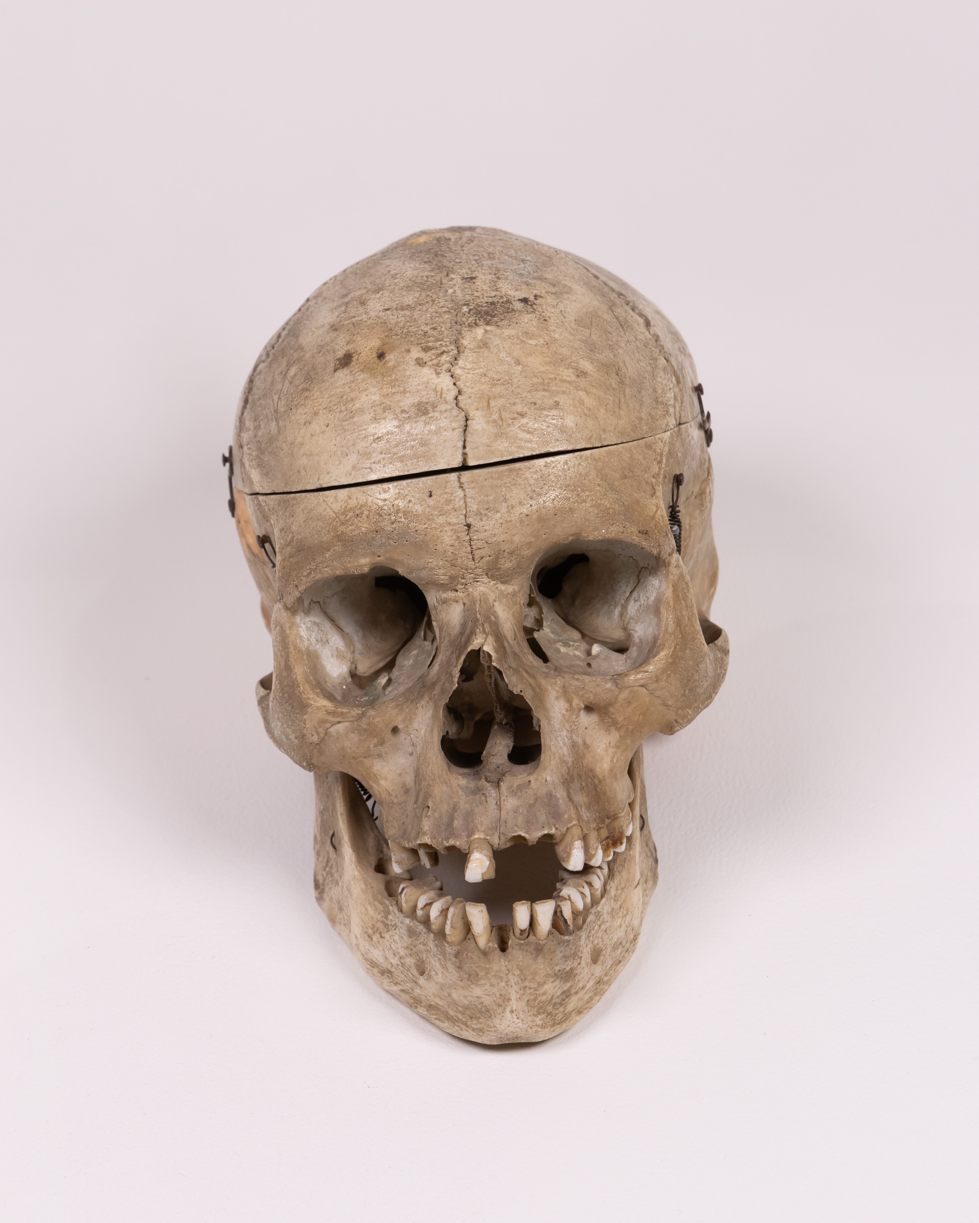 Antique Human Skull with Removable Skullcap