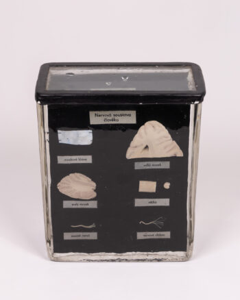 Vintage Anatomical Nervous System Model with Glass Case