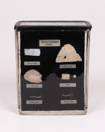 Vintage Anatomical Nervous System Model with Glass Case