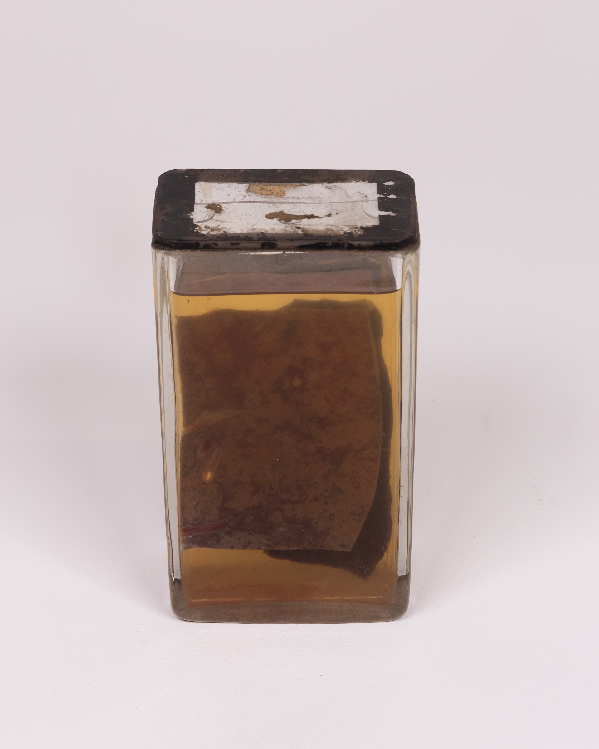 Vintage Preserved Specimen Jar with cirrhosis of the Liver Tissue Sample