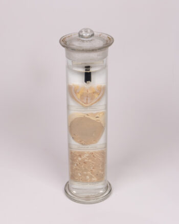 Antique Veterinary Pathology Wet Specimen — “Boubel/Uher” (Cysticercosis) of Larynx, Heart & Muscle — Czech, c.1900 (Porcine)