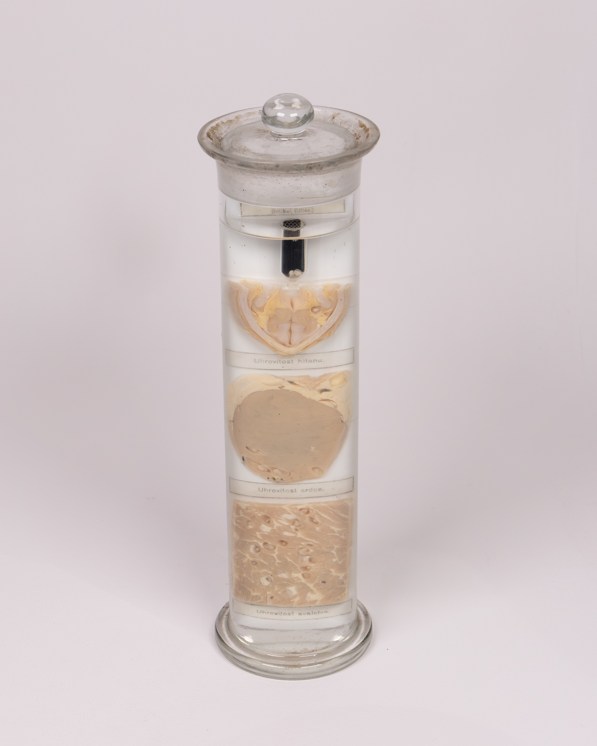 Antique Veterinary Pathology Wet Specimen — “Boubel/Uher” (Cysticercosis) of Larynx, Heart & Muscle — Czech, c.1900 (Porcine)